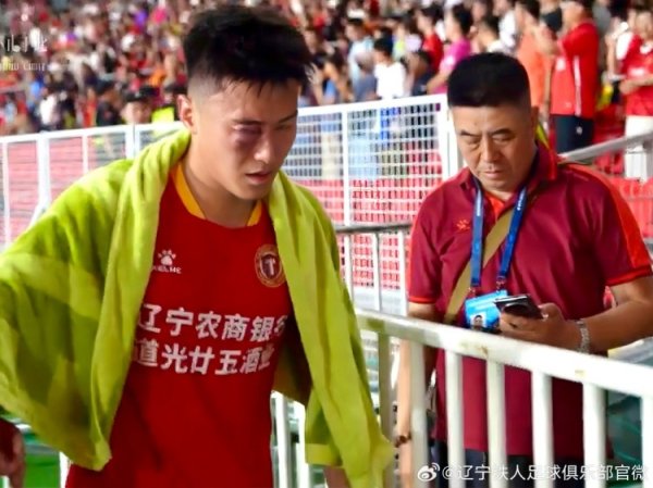 赵健博进行了鼻骨复位手术,需要等半个月后再进行复查
